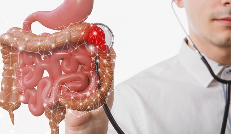 Cáncer de colon: más del 90% de casos se puede prevenir en sus etapas iniciales